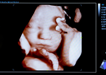 Urge Your Senators to Protect the Unborn