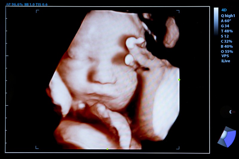 Gov. Newsom: Babies in Womb Not Neighbors